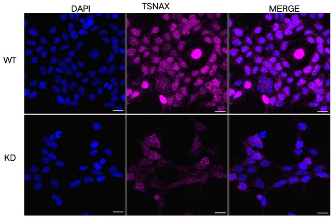 TSNAX Antibody in Immunocytochemistry (ICC/IF)