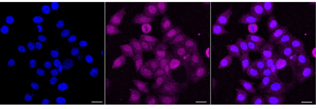 TRMT2A Antibody in Immunocytochemistry (ICC/IF)