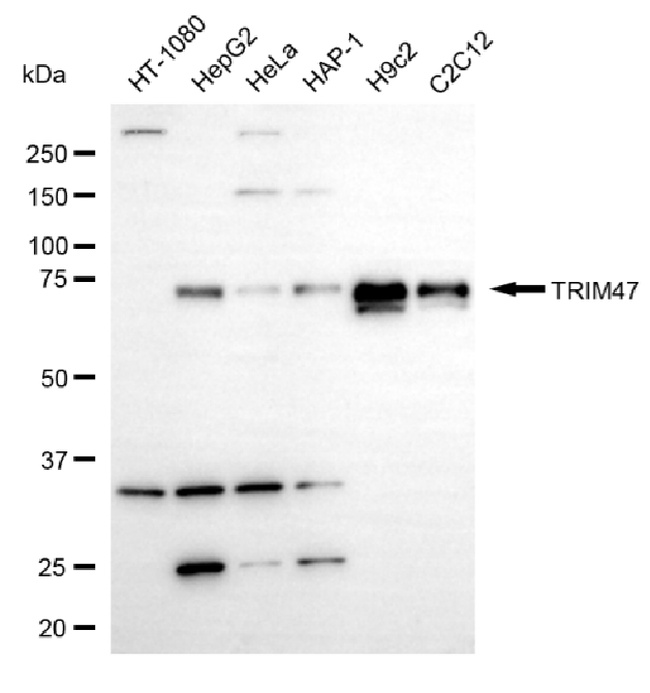TRIM47 Antibody in Western Blot (WB)