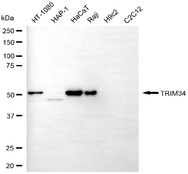 TRIM34 Antibody in Western Blot (WB)