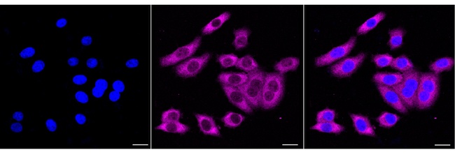 TRIM25 Antibody in Immunocytochemistry (ICC/IF)