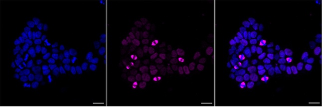 TPX2 Antibody in Immunocytochemistry (ICC/IF)