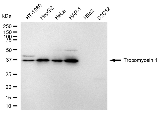 TPM1 Antibody in Western Blot (WB)