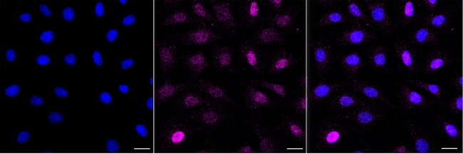 Torc2 Antibody in Immunocytochemistry (ICC/IF)