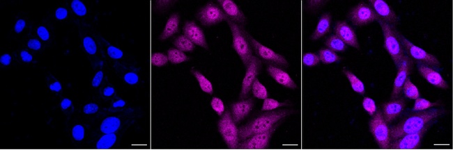 TNPO3 Antibody in Immunocytochemistry (ICC/IF)