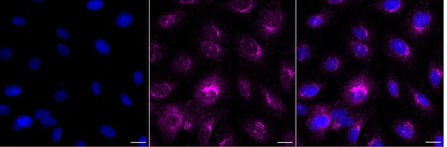 TMEM9B Antibody in Immunocytochemistry (ICC/IF)