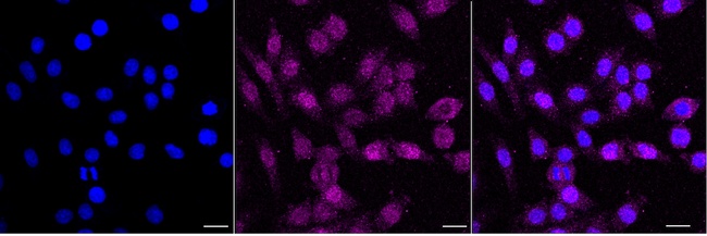 Thymidylate Synthase Antibody in Immunocytochemistry (ICC/IF)