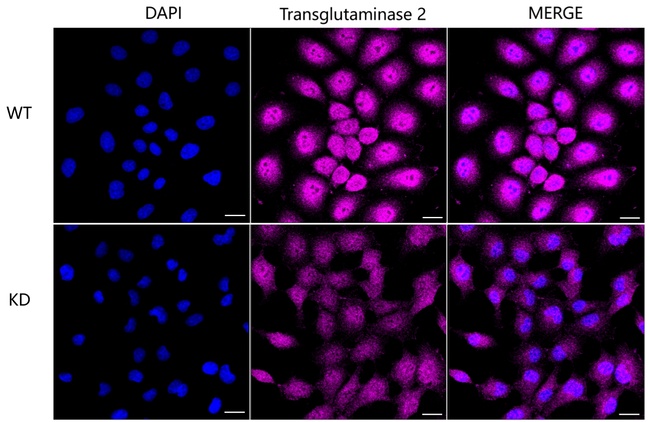 TGM2 Antibody in Immunocytochemistry (ICC/IF)