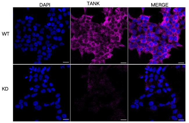 TANK Antibody in Immunocytochemistry (ICC/IF)