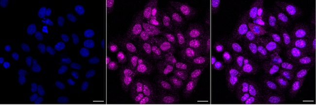 TAF1C Antibody in Immunocytochemistry (ICC/IF)
