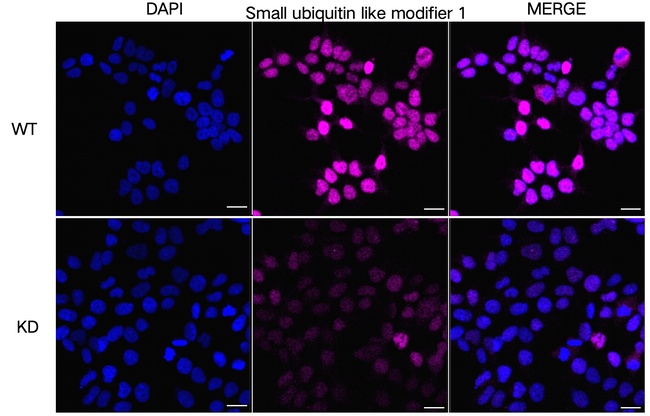 SUMO1 Antibody in Immunocytochemistry (ICC/IF)