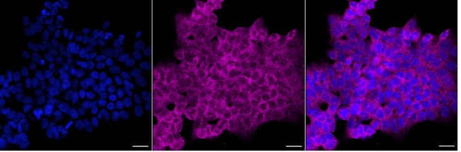 STRN4 Antibody in Immunocytochemistry (ICC/IF)