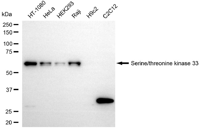 STK33 Antibody in Western Blot (WB)