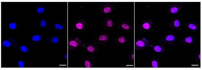 STAT6 Antibody in Immunocytochemistry (ICC/IF)