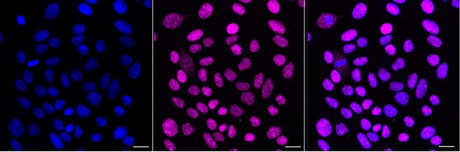 SSB Antibody in Immunocytochemistry (ICC/IF)