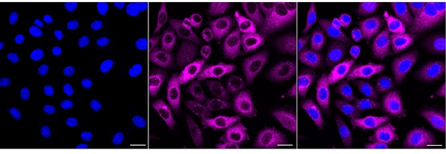 SQSTM1 Antibody in Immunocytochemistry (ICC/IF)