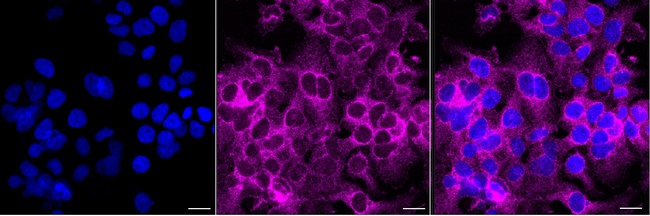 SNX9 Antibody in Immunocytochemistry (ICC/IF)