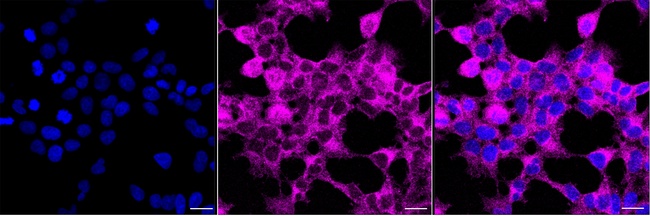 SNX9 Antibody in Immunocytochemistry (ICC/IF)