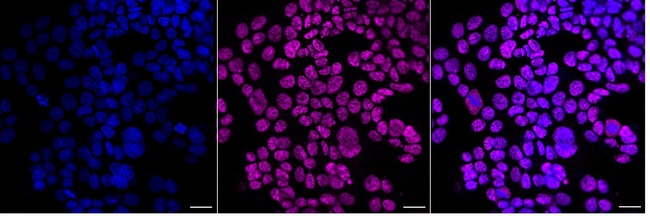 SNRPC Antibody in Immunocytochemistry (ICC/IF)