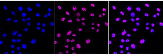 SNRPA1 Antibody in Immunocytochemistry (ICC/IF)