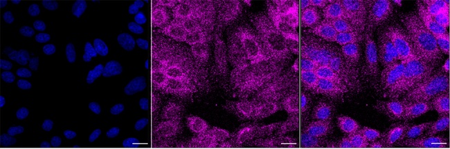 SMYD4 Antibody in Immunocytochemistry (ICC/IF)
