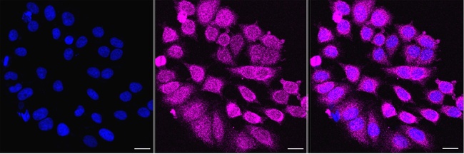 SIRT5 Antibody in Immunocytochemistry (ICC/IF)