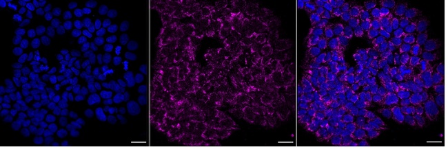 SIRT3 Antibody in Immunocytochemistry (ICC/IF)