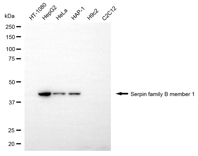SERPINB1 Antibody in Western Blot (WB)