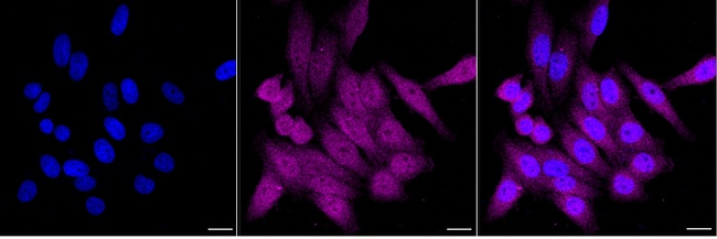 SERPINB1 Antibody in Immunocytochemistry (ICC/IF)
