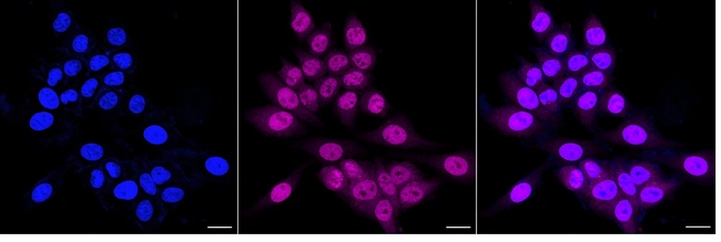 SENP1 Antibody in Immunocytochemistry (ICC/IF)