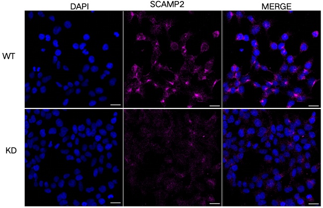 SCAMP2 Antibody in Immunocytochemistry (ICC/IF)