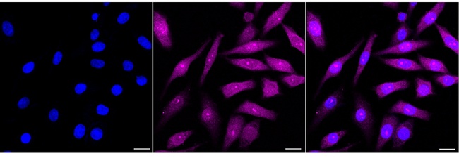 SBDS Antibody in Immunocytochemistry (ICC/IF)