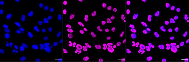 SAM68 Antibody in Immunocytochemistry (ICC/IF)