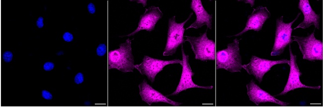 ROC1 Antibody in Immunocytochemistry (ICC/IF)