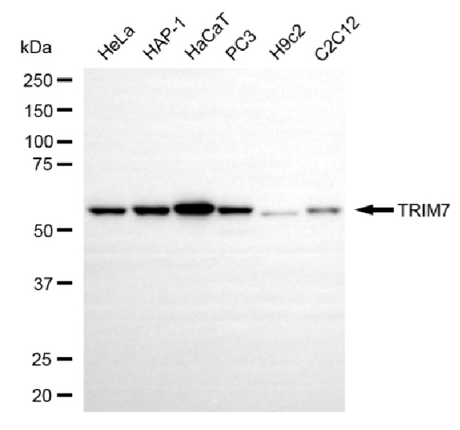 RNF90 Antibody in Western Blot (WB)
