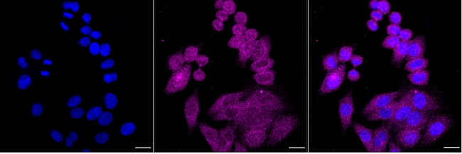 RhoGDI Antibody in Immunocytochemistry (ICC/IF)