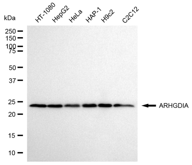 RhoGDI Antibody in Western Blot (WB)