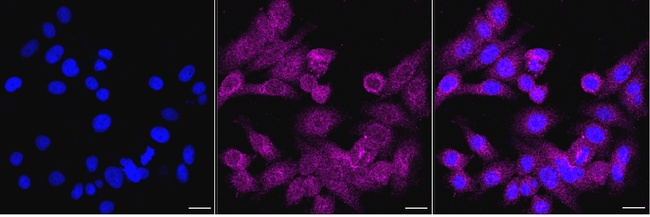 RhoGDI Antibody in Immunocytochemistry (ICC/IF)