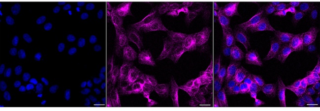 RHAMM Antibody in Immunocytochemistry (ICC/IF)