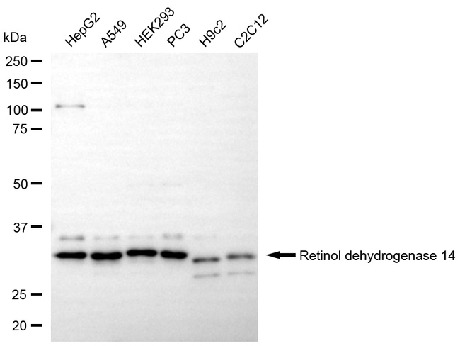RDH14 Antibody in Western Blot (WB)