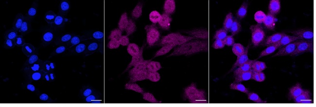 RAIDD Antibody in Immunocytochemistry (ICC/IF)