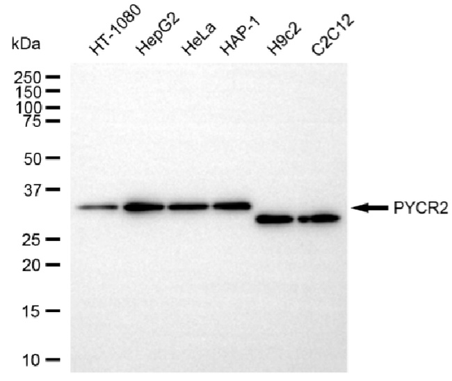 PYCR2 Antibody in Western Blot (WB)