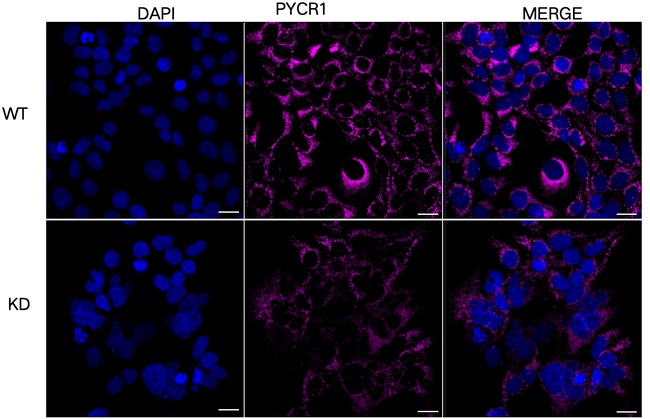 PYCR1 Antibody in Immunocytochemistry (ICC/IF)