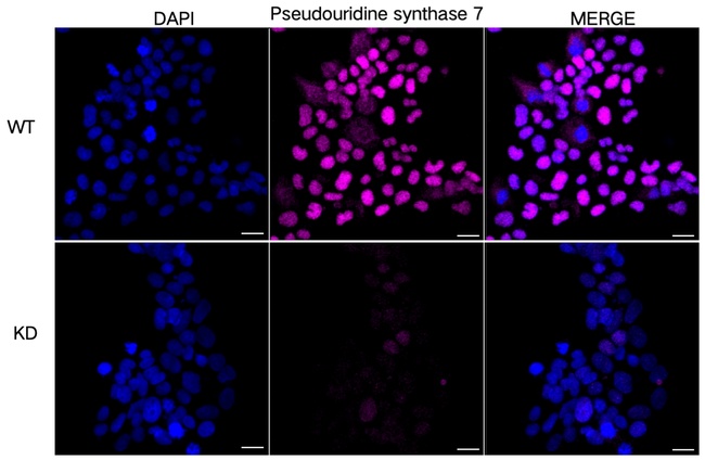 PUS7 Antibody in Immunocytochemistry (ICC/IF)