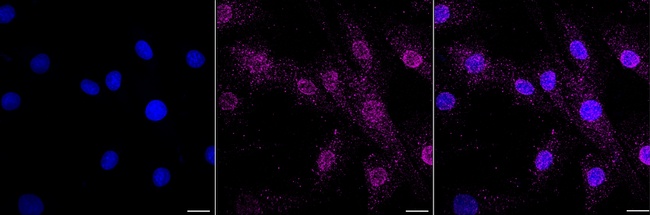 Progesterone Receptor Antibody in Immunocytochemistry (ICC/IF)