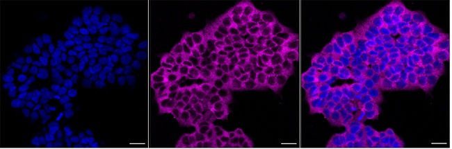 PRMT3 Antibody in Immunocytochemistry (ICC/IF)