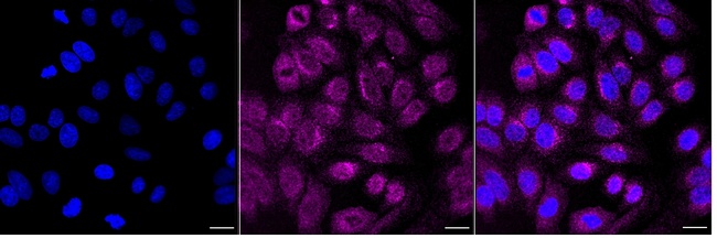 PREB Antibody in Immunocytochemistry (ICC/IF)
