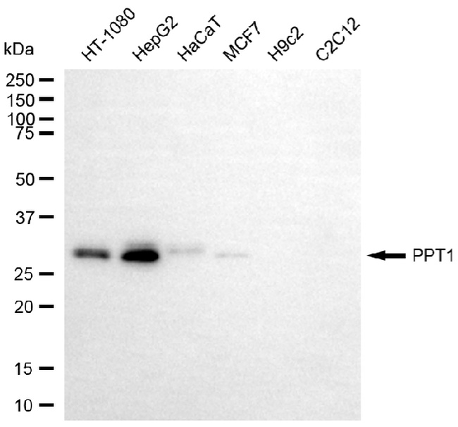 PPT1 Antibody in Western Blot (WB)