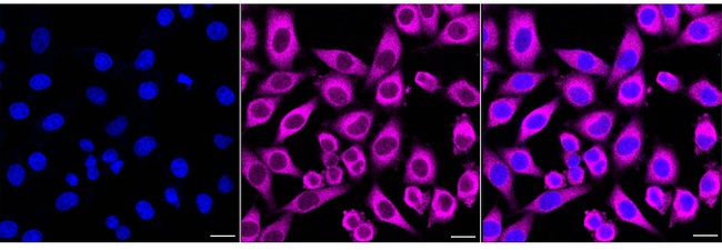 PP5 Antibody in Immunocytochemistry (ICC/IF)