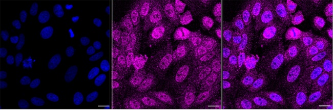 POLDIP2 Antibody in Immunocytochemistry (ICC/IF)